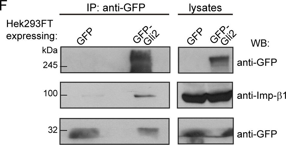 Detection of Human Importin beta/KPNB1 by Western Blot