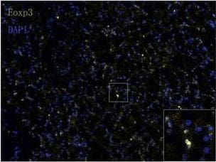 Detection of Human FoxP3 by Immunocytochemistry/Immunofluorescence