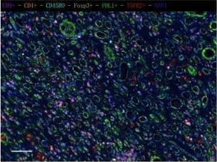 Detection of Human FoxP3 by Immunocytochemistry/Immunofluorescence