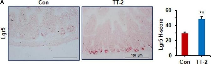 Detection of Lgr5/GPR49 by Immunohistochemistry