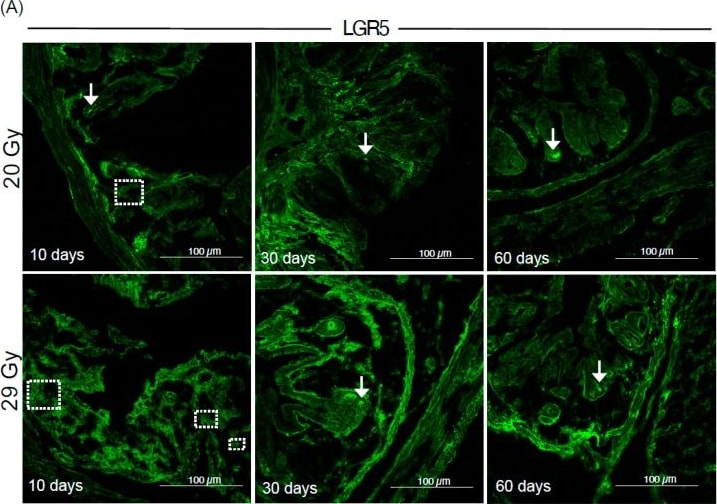 Detection of Lgr5/GPR49 by Immunohistochemistry