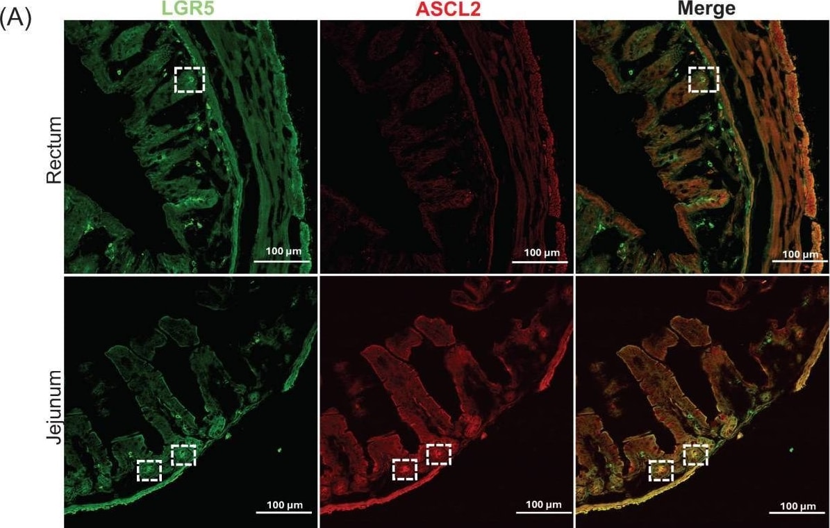 Detection of Lgr5/GPR49 by Immunohistochemistry
