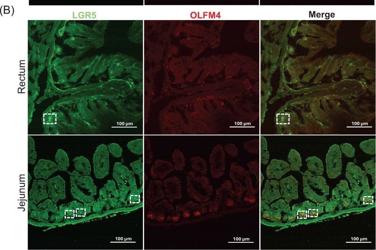 Detection of Lgr5/GPR49 by Immunohistochemistry