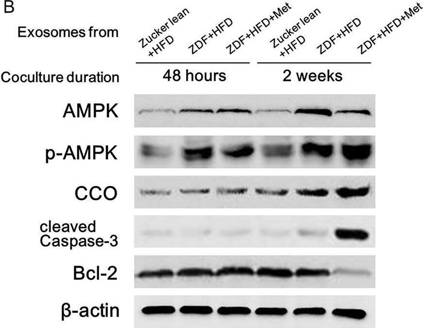 Detection of Bcl-2 by Western Blot