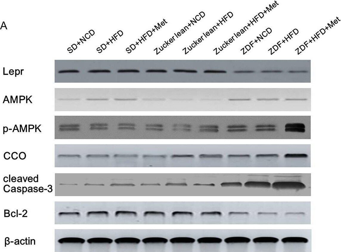 Detection of Bcl-2 by Western Blot