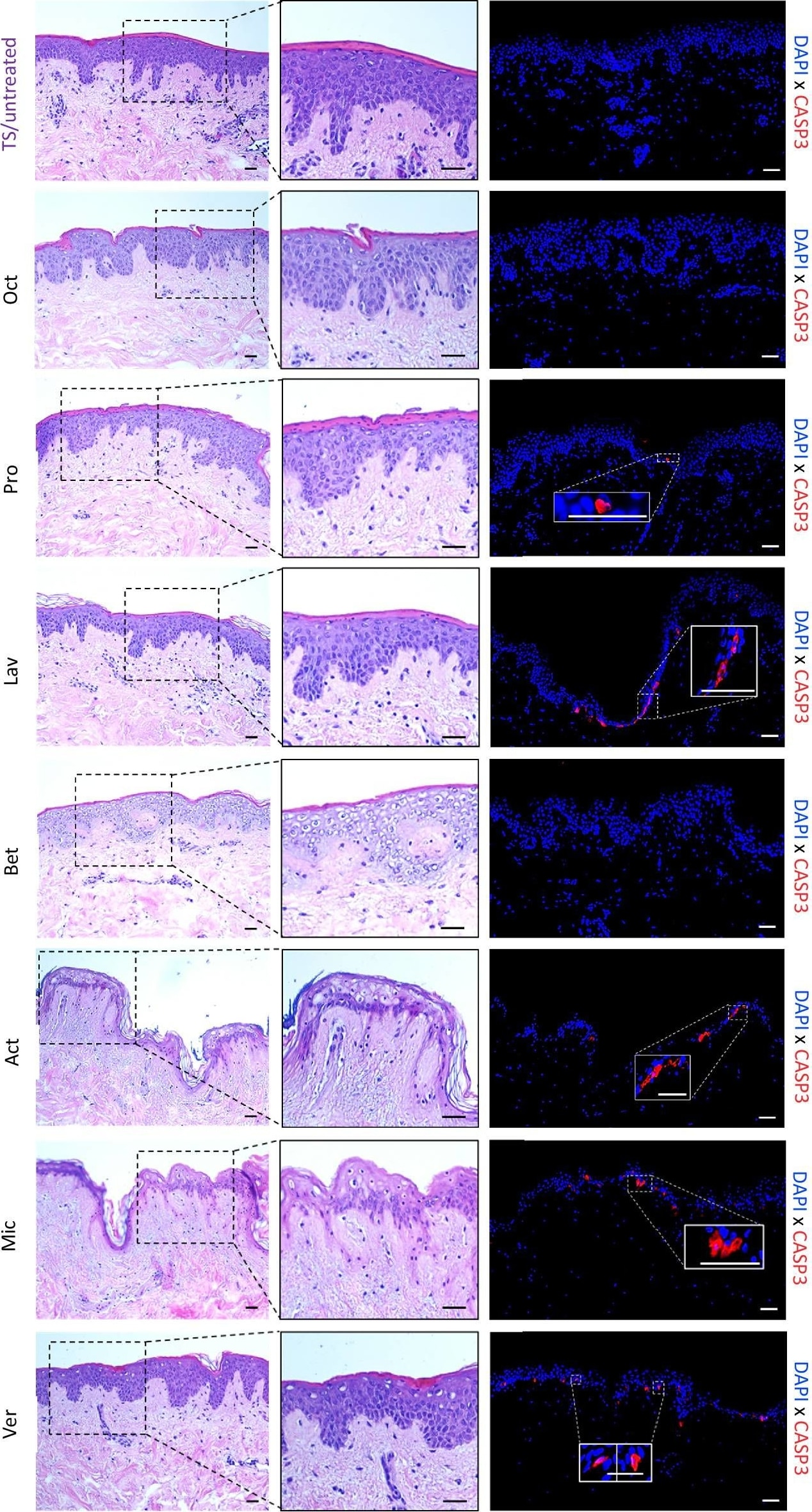 Detection of Human Human/Mouse Cleaved Caspase-3 (Asp175) Antibody by Immunohistochemistry