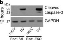 Detection of Human Caspase-3 by Western Blot