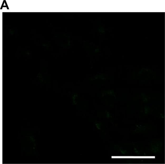 Detection of Human Caspase-3 by Immunocytochemistry/Immunofluorescence