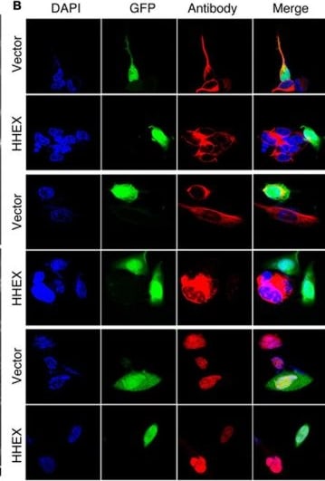 Detection of bl2vlcbkhad3mwbg8e4s.jpg by Immunocytochemistry/ Immunofluorescence