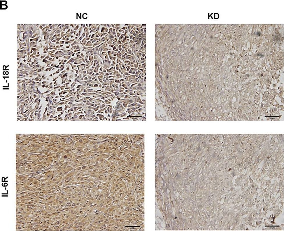 Detection of IL-18 R alpha /IL-1 R5 by Immunohistochemistry