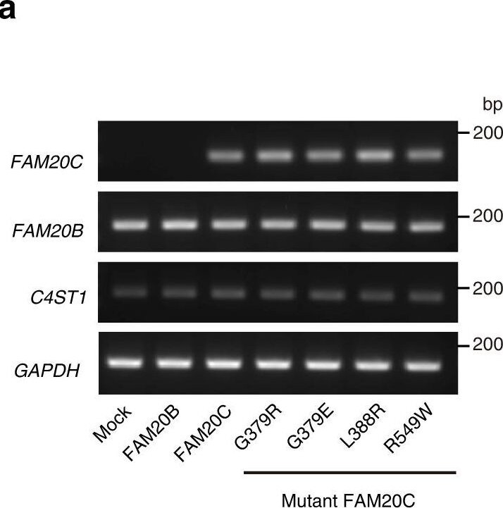 Detection of FAM20B by Western Blot