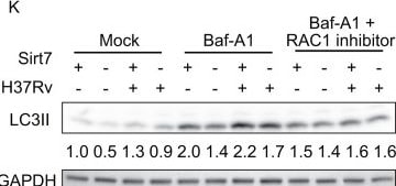Detection of LC3B by Western Blot