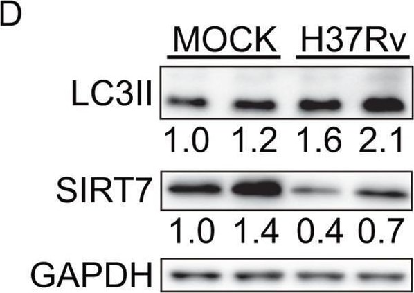 Detection of LC3B by Western Blot