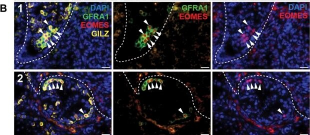 Detection of eugbwzbvlvimpbcwmd1y.jpg by Immunohistochemistry