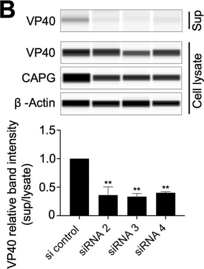 Detection of Human  beta -Actin by Western Blot