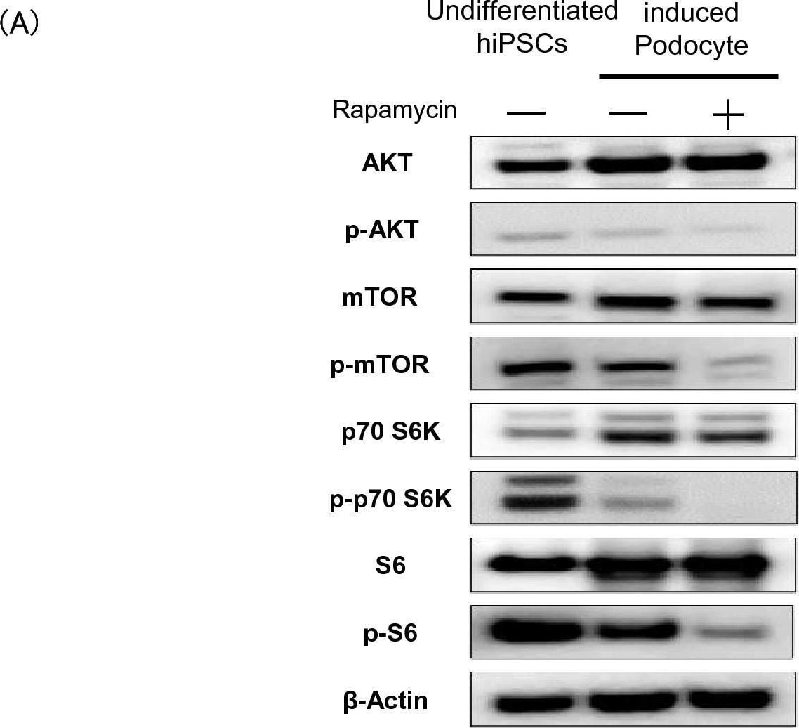 Detection of  beta -Actin by Western Blot