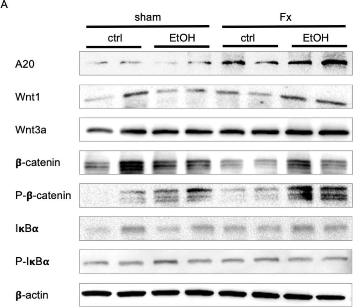 Detection of  beta -Actin by Western Blot