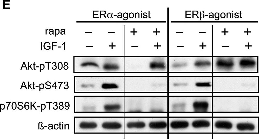 Detection of Mouse p70 S6 Kinase/S6K by Western Blot