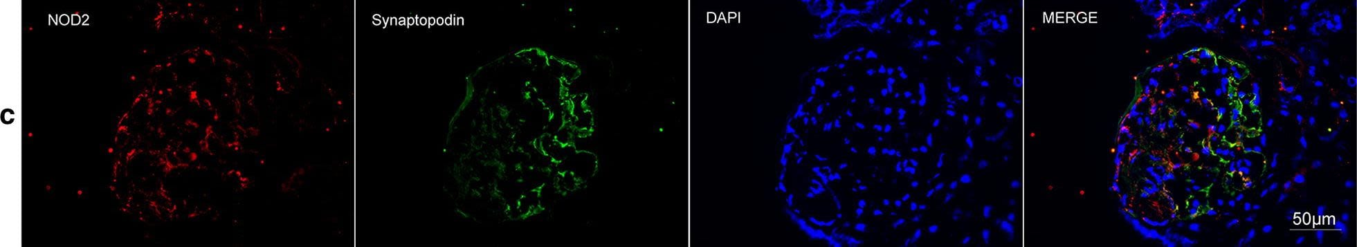 Detection of Human Synaptopodin by Immunocytochemistry/Immunofluorescence