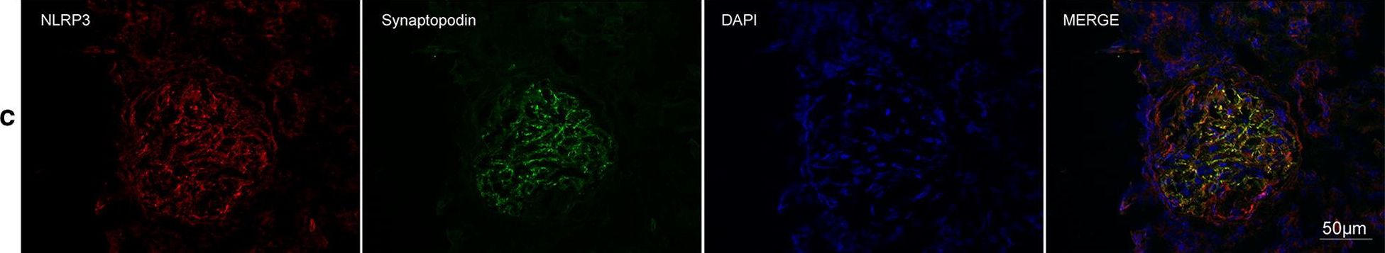 Detection of Human Synaptopodin by Immunocytochemistry/Immunofluorescence