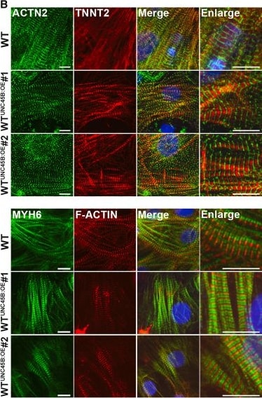Detection of cqbumwuxr5qxaj4pkse2.jpg by Immunocytochemistry/ Immunofluorescence