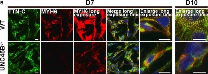 Detection of aca2xvxrfugv1hkppchb.jpg by Immunohistochemistry
