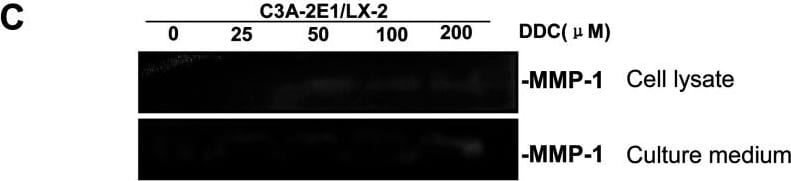Detection of Human MMP-1 by Western Blot