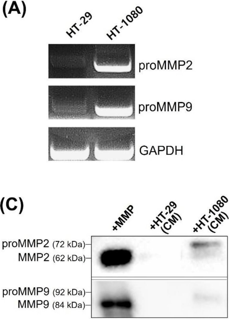 Detection of MMP-2 by Western Blot