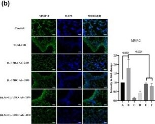 Detection of MMP-2 by Immunocytochemistry/ Immunofluorescence