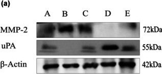 Detection of MMP-2 by Western Blot