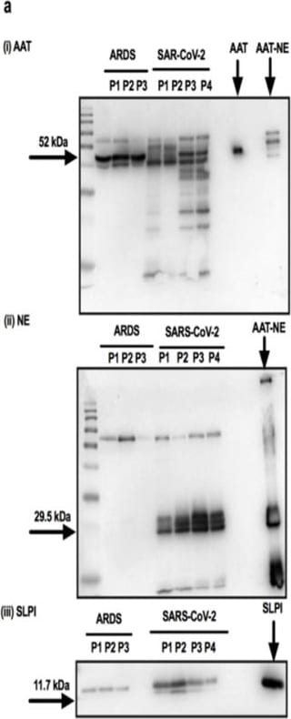 Detection of Neutrophil Elastase/ELA2 by Western Blot