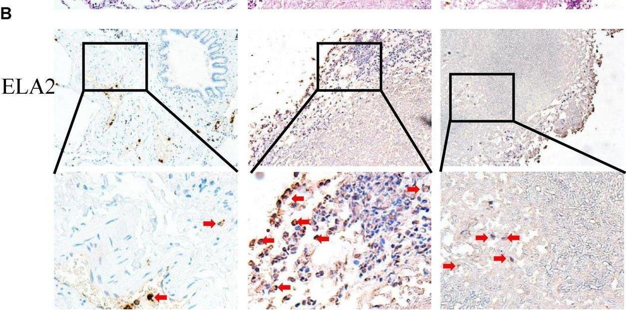 Detection of jd1tnkhf1wwwy2olcudc.jpg by Immunohistochemistry