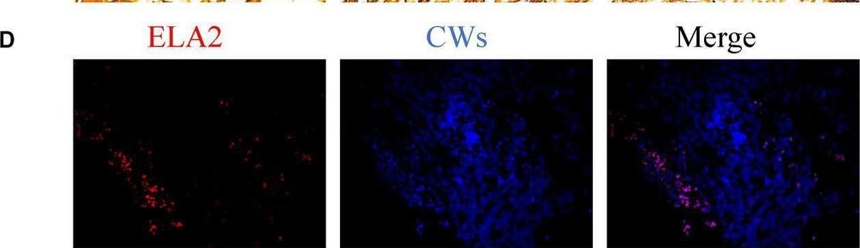 Detection of Neutrophil Elastase/ELA2 by Immunohistochemistry