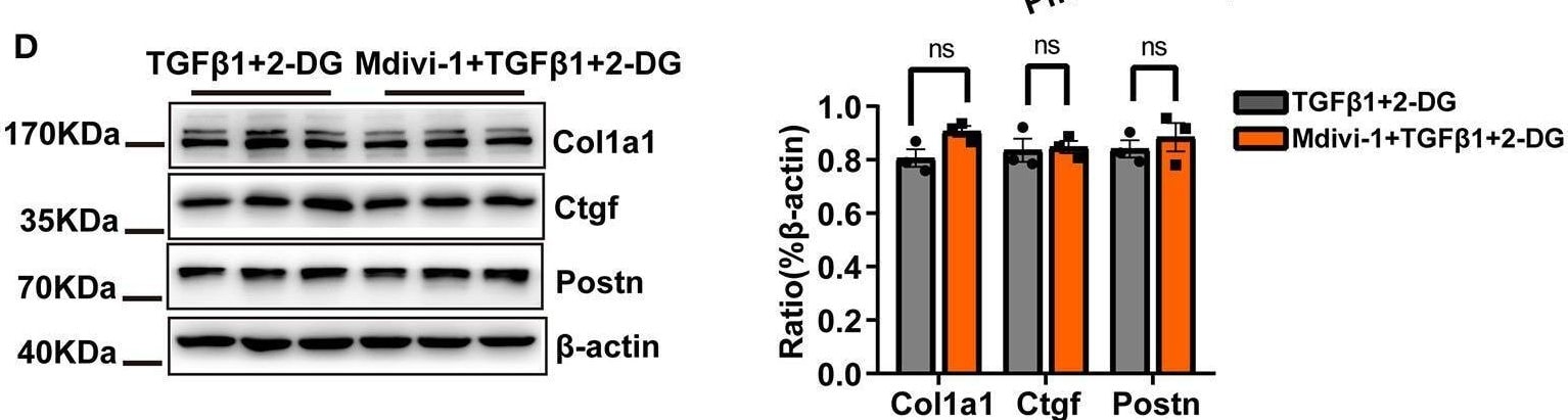 Detection of CTGF/CCN2 by Western Blot