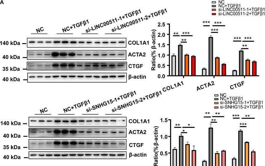 Detection of CTGF/CCN2 by Western Blot
