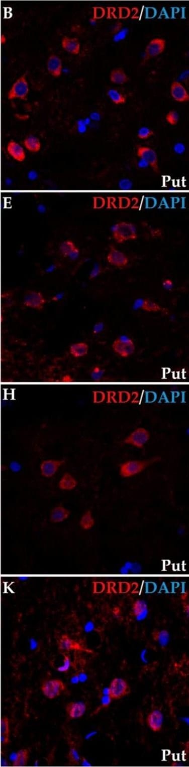 Detection of Human Dopamine D2R/DRD2 by Immunocytochemistry/ Immunofluorescence
