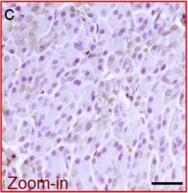 Detection of Human ACE-2 by Immunocytochemistry/Immunofluorescence