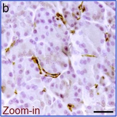 Detection of Human ACE-2 by Immunohistochemistry