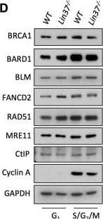 Detection of FANCD2 by Western Blot