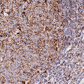 Human IgM Antibody