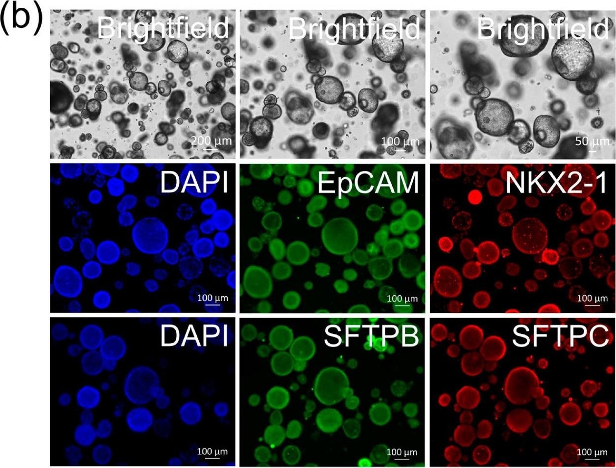Detection of TTF-1/NKX2-1 by Immunocytochemistry/ Immunofluorescence