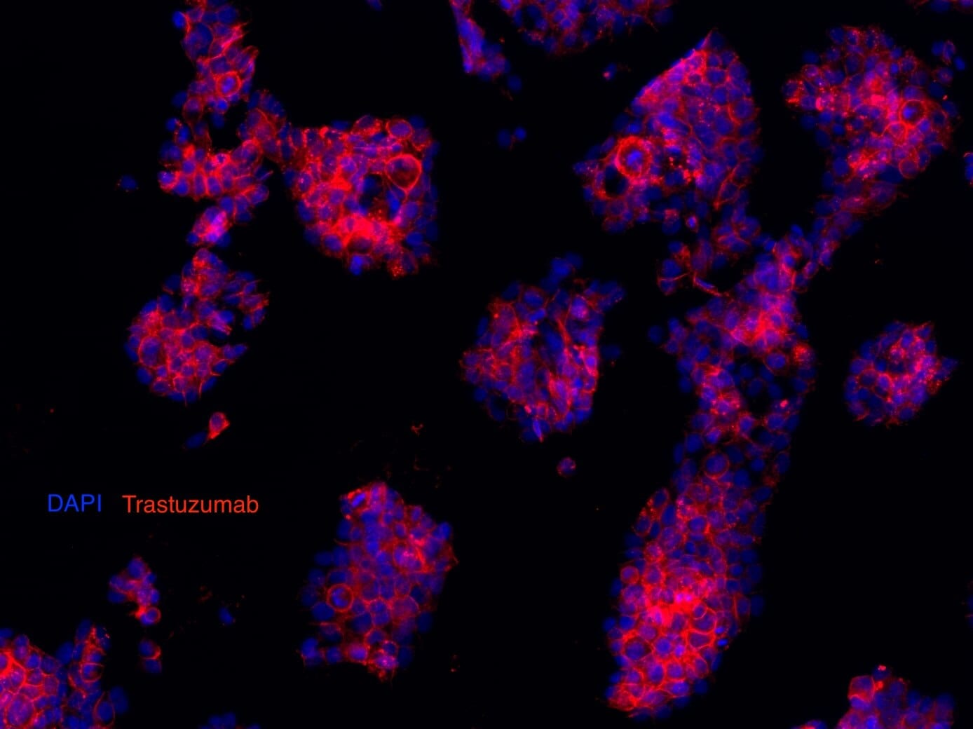 Detection of Trastuzumab by Immunocytochemistry.
