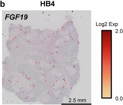 Detection of d2uktu72gwvnainbyzhf.jpg by Immunohistochemistry