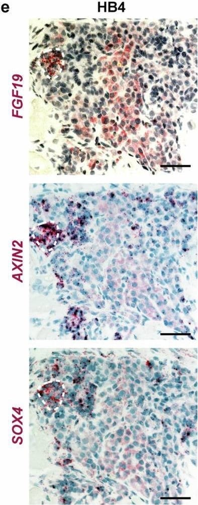 Detection of FGF-19 by Immunohistochemistry