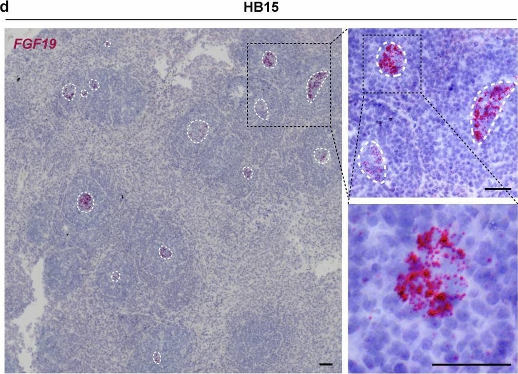 Detection of FGF-19 by Immunohistochemistry