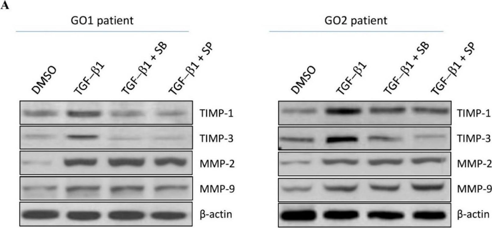 Detection of TIMP-1 by Western Blot