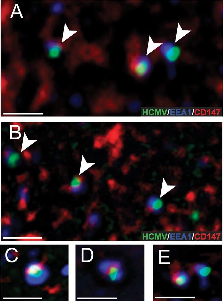 Detection of Human EMMPRIN/CD147 by Immunocytochemistry/Immunofluorescence
