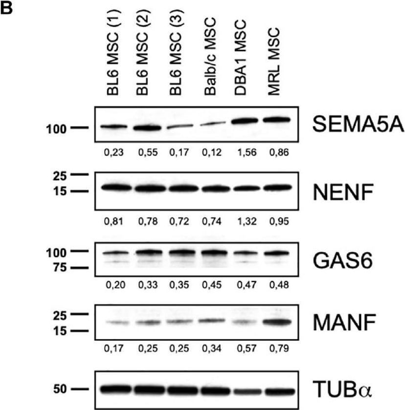 Detection of Gas6 by Western Blot