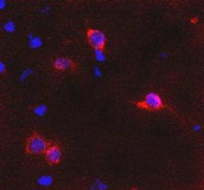 Immunocytochemistry/ Immunofluorescence: mGluR6 Antibody [NB300-189]