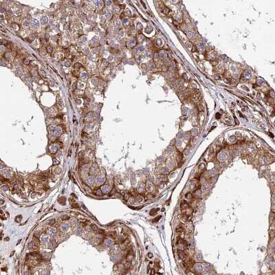 Immunohistochemistry-Paraffin: midA Antibody [NBP1-91728]